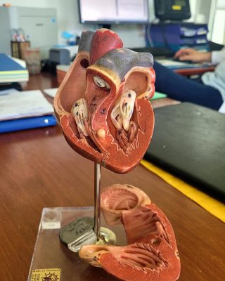 📣 𝘿𝙖𝙣𝙨 𝙢𝙤𝙞𝙣𝙨 𝙙’𝙪𝙣 𝙢𝙤𝙞𝙨, 𝙔𝙤𝙪𝙘𝙚𝙛 𝙙𝙚𝙫𝙧𝙖𝙞𝙩 𝙨𝙚 𝙛𝙖𝙞𝙧𝙚 𝙤𝙥é𝙧𝙚𝙧, 𝙡𝙖 #𝙎𝙚𝙚𝙙𝙁𝙖𝙢𝙞𝙡𝙮 !
 
Voici des nouvelles de notre petit protégé atteint depuis la naissance d’une malformation cardiaque : suite à un examen de contrôle, son état est jugé un peu faible… 🙏
 
Il a besoin de beaucoup de repos - et de tout notre soutien ! - pour se préparer à son opération qui va durer environ 5 heures !

Un maximum de ❤ pour Youcef dans les commentaires 

#santé #enfants #coeur #malformation #opération